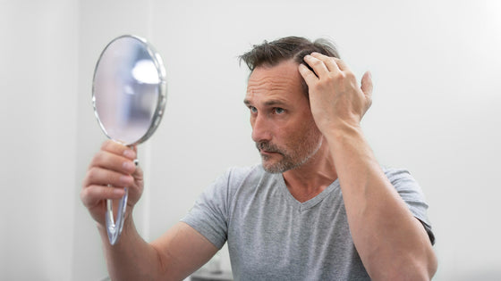 Tipos de alopecia e os cuidados que você precisa ter